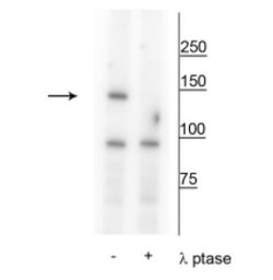 FANCI, p Ser556 Antibody, Novus Biologicals 100&mu;L:Antibodies, Polyclonal