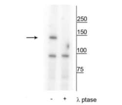 FANCI, p Ser559 Antibody, Novus Biologicals 100&mu;L:Antibodies, Polyclonal