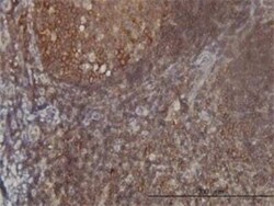 FARSB Antibody (2F11), Novus Biologicals 0.1 mg | Buy Online | Novus Biologicals | Fisher Scientific