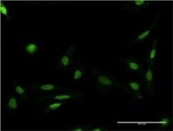FASTK Antibody (2B7), Novus Biologicals 0.1 mg | Buy Online | Novus Biologicals | Fisher Scientific