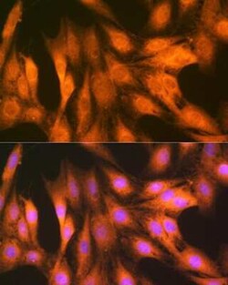 FAT10 Rabbit anti-Human, Mouse, Rat, Clone: 10A6T5, Novus Biologicals 20