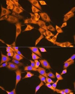 FAT10 Rabbit anti-Human, Mouse, Rat, Clone: 10A6T5, Novus Biologicals 20