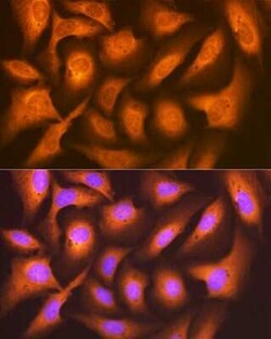 FAT10 Rabbit anti-Human, Mouse, Rat, Clone: 10A6T5, Novus Biologicals 20