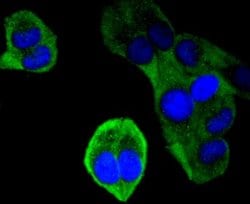 FAT10 Rabbit anti-Human, Clone: JJ084-09, Novus Biologicals 100&mu;L:Antibodies,