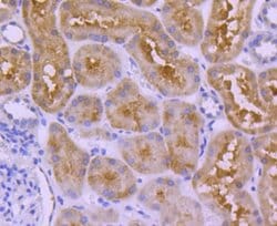 FAT10 Rabbit anti-Human, Clone: JJ084-09, Novus Biologicals 100&mu;L:Antibodies,