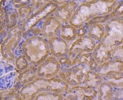 FAT10 Rabbit anti-Human, Clone: JJ084-09, Novus Biologicals 100&mu;L:Antibodies,