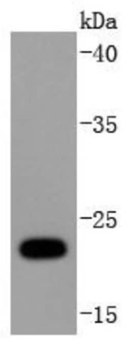 FAT10 Rabbit anti-Human, Clone: JJ084-09, Novus Biologicals 100&mu;L:Antibodies,