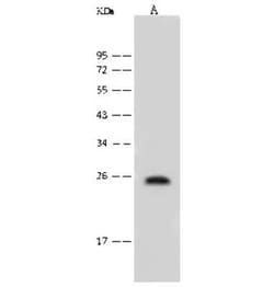 FAT10 Antibody, Novus Biologicals:Antibodies:Primary Antibodies