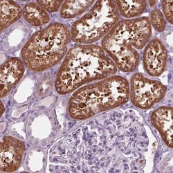 FATP2/SLC27A2 Antibody, Novus Biologicals 100 &mu;g | Buy Online | Novus Biologicals | Fisher Scientific