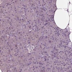 FATP2/SLC27A2 Antibody, Novus Biologicals 100 &mu;g | Buy Online | Novus Biologicals | Fisher Scientific