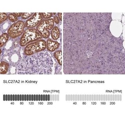 FATP2/SLC27A2 Antibody, Novus Biologicals 100 &mu;g | Buy Online | Novus Biologicals | Fisher Scientific