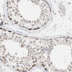 FATP4/SLC27A4 Antibody, Novus Biologicals:Antibodies:Primary Antibodies