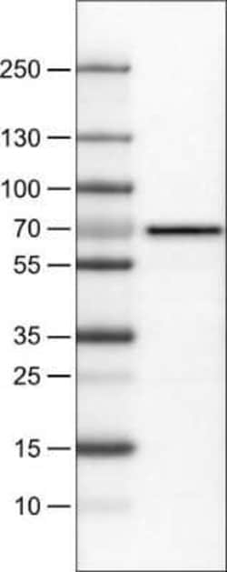FATP5/SLC27A5 Antibody (CL0216), Novus Biologicals 0.1 mL, Unconjugated:Antibodies,