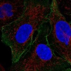 FBP2 Rabbit anti-Human, Polyclonal, Novus Biologicals 100 &mu;g; Unconjugated:Antibodies,