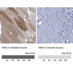 FBP2 Rabbit anti-Human, Polyclonal, Novus Biologicals 100 &mu;g; Unconjugated:Antibodies,