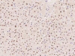 FBP2 Antibody, Novus Biologicals 50 &mu;g, Unconjugated:Antibodies, Polyclonal