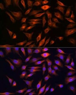 FBPase 1 Rabbit anti-Human, Mouse, Rat, Clone: 7N8C1, Novus Biologicals 20 &mu;g | Buy Online | Novus Biologicals | Fisher Scientific