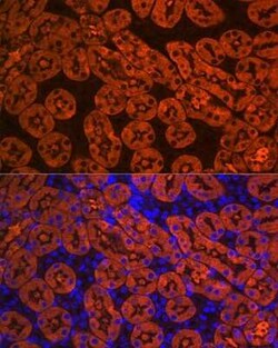 FBPase 1 Rabbit anti-Human, Mouse, Rat, Clone: 7N8C1, Novus Biologicals 20 &mu;g | Buy Online | Novus Biologicals | Fisher Scientific