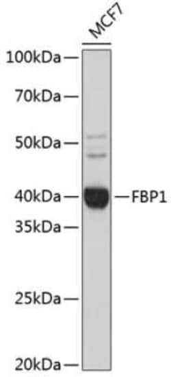 FBPase 1 Rabbit anti-Human, Mouse, Rat, Clone: 7N8C1, Novus Biologicals 20 &mu;g | Buy Online | Novus Biologicals | Fisher Scientific