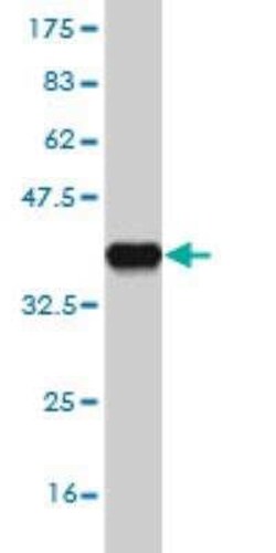 FBXL13 Antibody (1F7), Novus Biologicals 0.1 mg | Buy Online | Novus Biologicals | Fisher Scientific