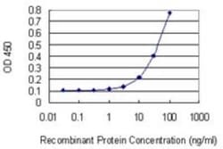 FBXL19 Antibody (3C5), Novus Biologicals 0.1 mg | Buy Online | Novus Biologicals | Fisher Scientific