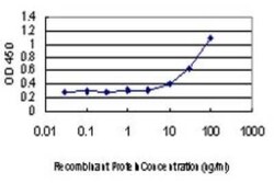 FBXO25 Antibody (2F1), Novus Biologicals 0.1 mg | Buy Online | Novus Biologicals | Fisher Scientific