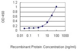 FBXO28 Antibody (3E5), Novus Biologicals 0.1 mg | Buy Online | Novus Biologicals | Fisher Scientific