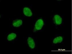 FBXO28 Antibody, Novus Biologicals 0.05 mg | Buy Online | Novus Biologicals | Fisher Scientific
