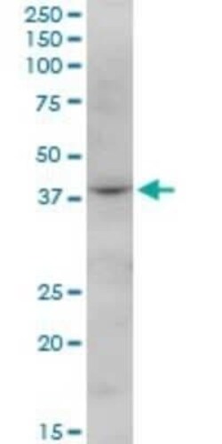 FBXO28 Antibody, Novus Biologicals 0.05 mg | Buy Online | Novus Biologicals | Fisher Scientific