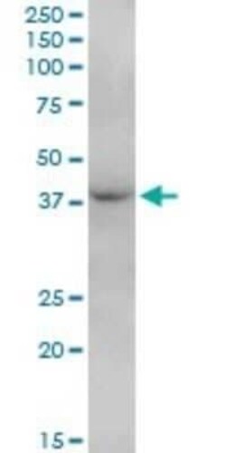 FBXO28 Antibody, Novus Biologicals 0.05 mg | Buy Online | Novus Biologicals | Fisher Scientific
