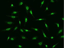 FBXO34 Antibody, Novus Biologicals 100 &mu;g | Buy Online | Novus Biologicals | Fisher Scientific