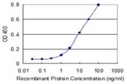 FBXO36 Antibody (3D3), Novus Biologicals 0.1 mg | Buy Online | Novus Biologicals | Fisher Scientific