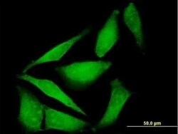 FBXO40 Antibody, Novus Biologicals 0.05 mg | Buy Online | Novus Biologicals | Fisher Scientific