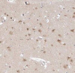 FBXO42 Antibody, Novus Biologicals 25 &mu;L; Unconjugated:Antibodies, Polyclonal