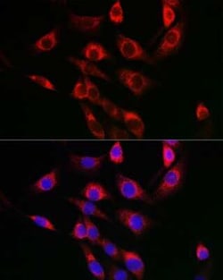 FBXO6 Rabbit anti-Human, Mouse, Polyclonal, Novus Biologicals:Antibodies:Primary