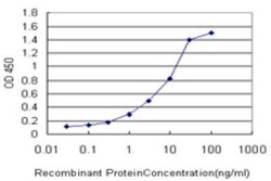 FBXO8 Antibody (1C11), Novus Biologicals 0.1 mg | Buy Online | Novus Biologicals | Fisher Scientific
