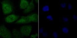 FBXW7/Cdc4 Antibody, Novus Biologicals 100 &mu;g; Unconjugated:Antibodies,