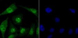 FBXW7/Cdc4 Antibody, Novus Biologicals 100 &mu;g; Unconjugated:Antibodies,