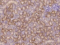 FCAMR Antibody, Novus Biologicals 100 &mu;g; Unconjugated:Antibodies, Polyclonal