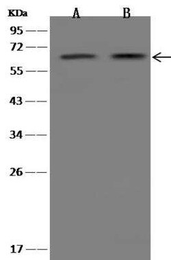 FCAMR Antibody, Novus Biologicals 100 &mu;g; Unconjugated:Antibodies, Polyclonal