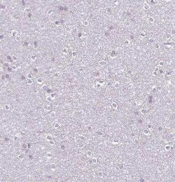 FCRL3/FcRH3 Antibody, Novus Biologicals 100 &mu;g; Unconjugated:Antibodies,