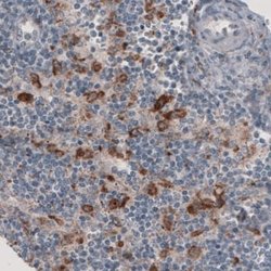 FCRN/FCGRT Antibody (CL3638), Novus Biologicals 100&mu;L:Antibodies, Monoclonal