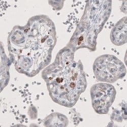 FCRN/FCGRT Antibody (CL3638), Novus Biologicals 100&mu;L:Antibodies, Monoclonal