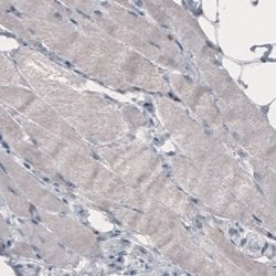 FCRN/FCGRT Antibody (CL3638), Novus Biologicals 100&mu;L:Antibodies, Monoclonal