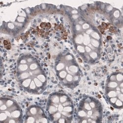 FCRN/FCGRT Antibody (CL3640), Novus Biologicals 25 &mu;L:Antibodies, Monoclonal