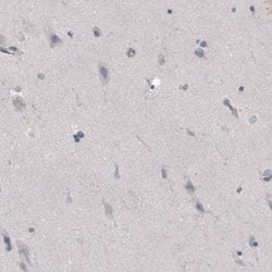 FCRN/FCGRT Antibody (CL3640), Novus Biologicals 25 &mu;L:Antibodies, Monoclonal