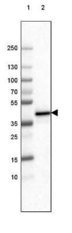 FCRN/FCGRT Antibody (CL3640), Novus Biologicals 25 &mu;L:Antibodies, Monoclonal