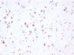 FCRN/FCGRT Mouse anti-Human, Clone: FCGRT/2932, Novus Biologicals:Antibodies:Primary