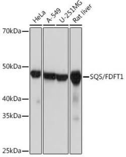FDFT1 Rabbit anti-Human, Mouse, Rat, Clone: 4W10J4, Novus Biologicals 20