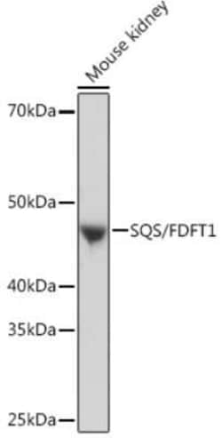 FDFT1 Rabbit anti-Human, Mouse, Rat, Clone: 4W10J4, Novus Biologicals 20